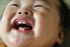 close up of baby showing 4 new teeth